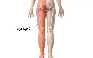 آیا درد لگن شما به دیسک کمر مرتبط است؟