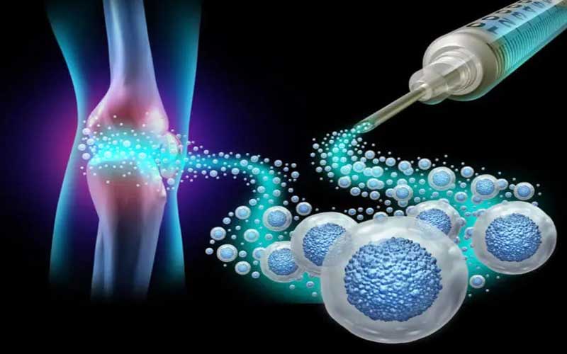 مراقبتهای پس از سلولدرمانی چیست؟ | راهنمای کامل برای بهبودی بهتر پس از درمان سلولی