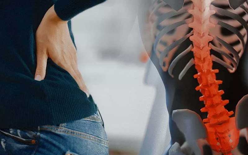 تفاوت دیسک کمر و سیاتیک چیست؟ | بررسی جامع علائم، علل و روشهای درمان